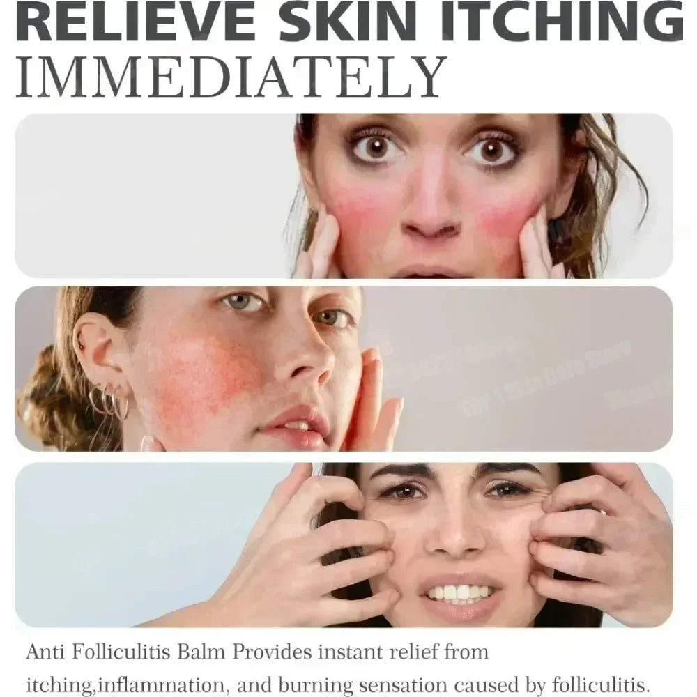 Clear Skin Rescue Cream™