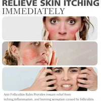 Clear Skin Rescue Cream™