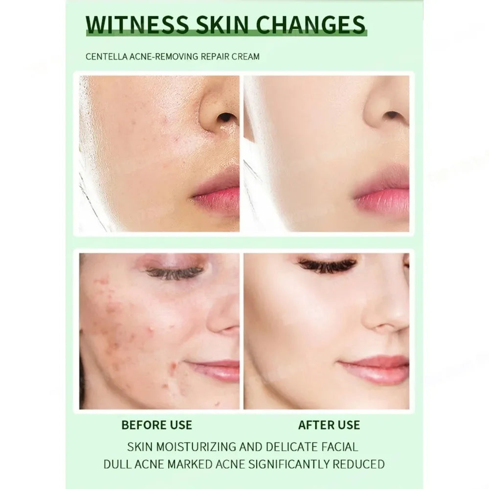 Clear Skin Rescue Cream™