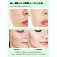 Clear Skin Rescue Cream™